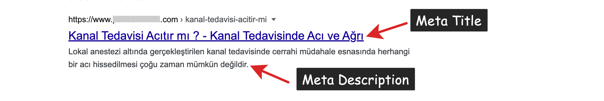 Meta title ve description, site iÃ§i SEO'nun en Ã¶nemli kriterlerindendir.